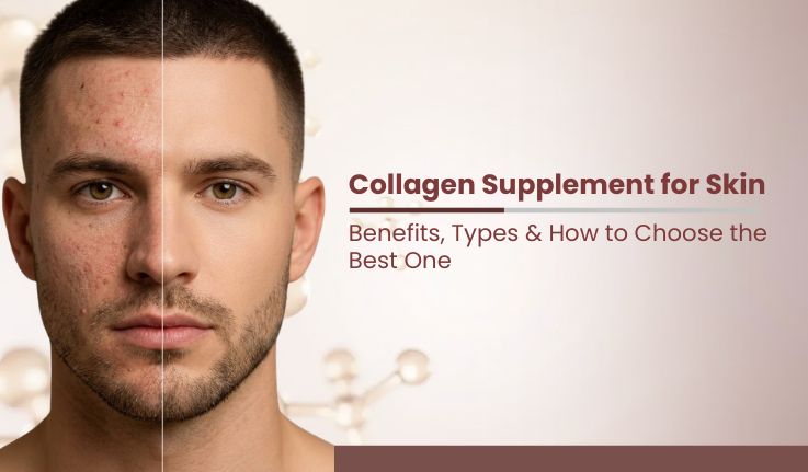 Collagen Supplement for Skin: Benefits, Types & How to Choose the Best One